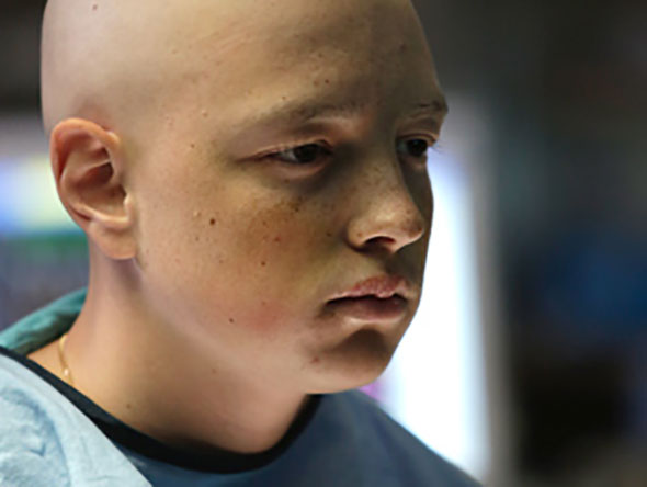Bald boy looking away from camera in hospital gown